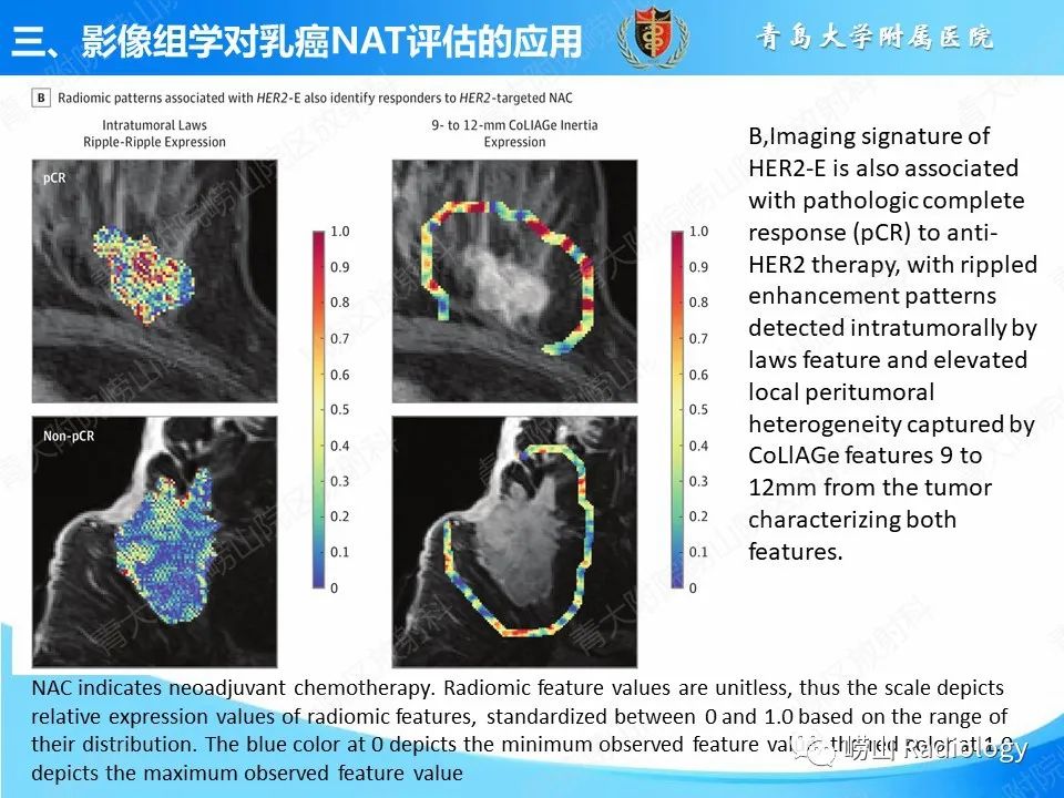 影像PPT - 【PPT】基于影像组学评估乳腺癌新辅助治疗效果-19