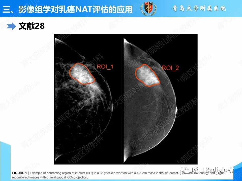 影像PPT - 【PPT】基于影像组学评估乳腺癌新辅助治疗效果-23