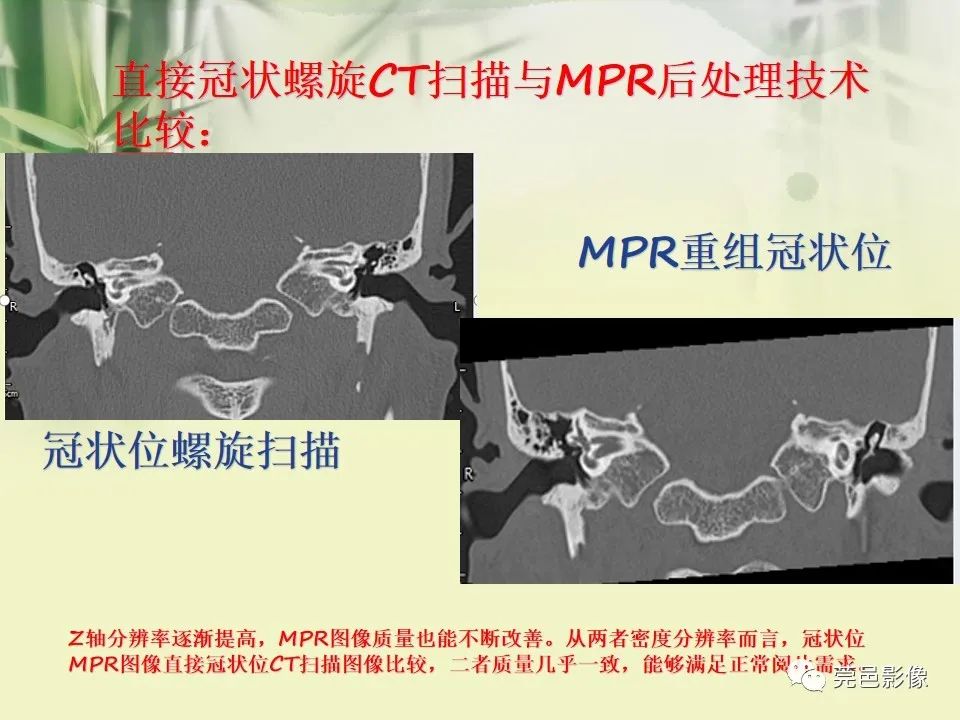 影像PPT - 【PPT】CT高分辨骨算法对中内耳扫描重建技术的探索与总结-9