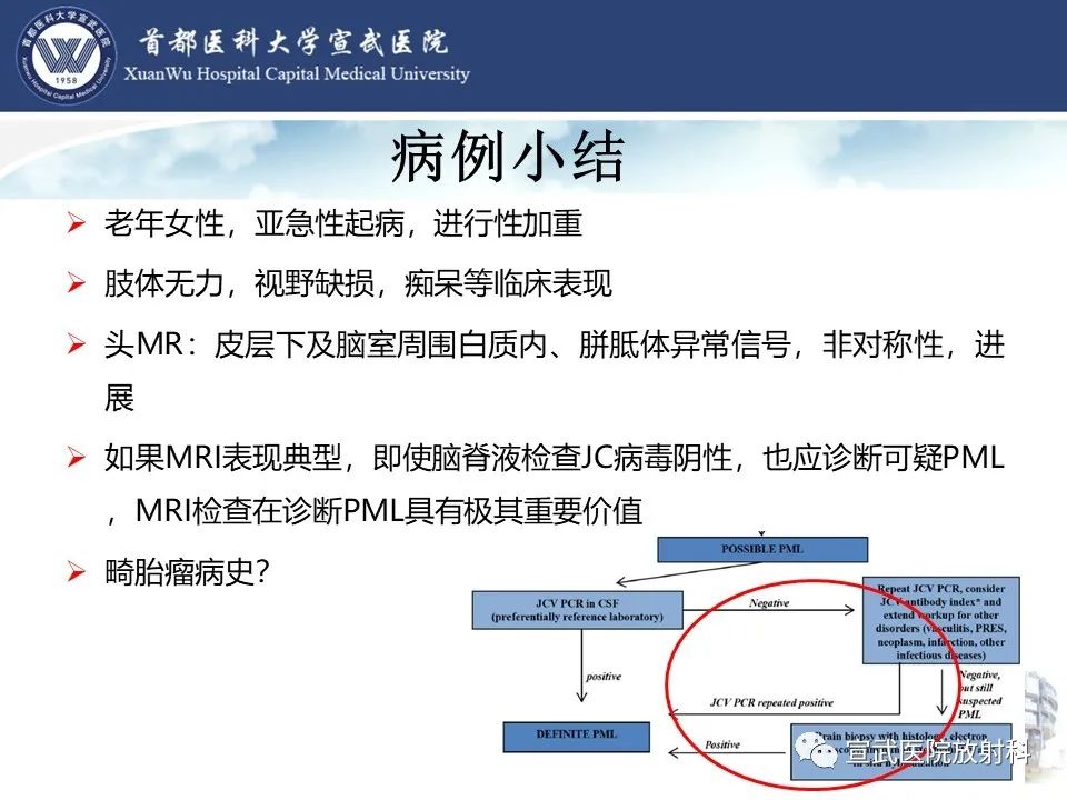 影像PPT - 【病例】进行性多灶性白质脑病1例CT及MR影像表现-25