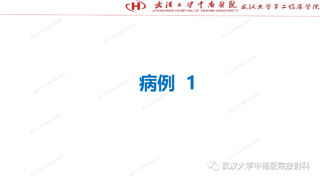 影像PPT - 【PPT】“不可切除”肝癌的TACE转化治疗-13