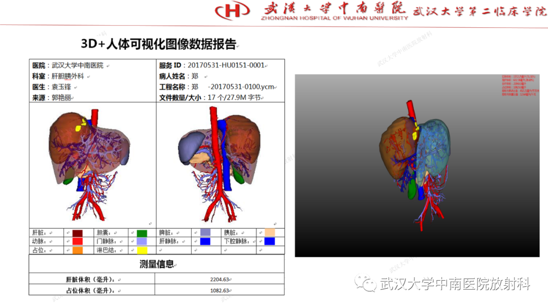 影像PPT - 【PPT】“不可切除”肝癌的TACE转化治疗-17