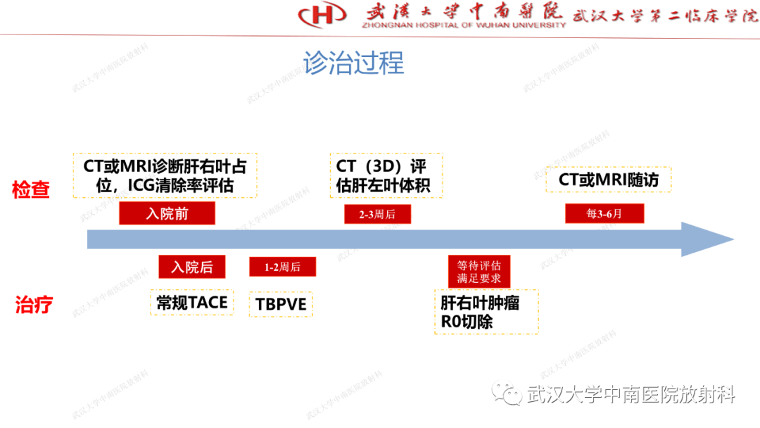 影像PPT - 【PPT】“不可切除”肝癌的TACE转化治疗-21