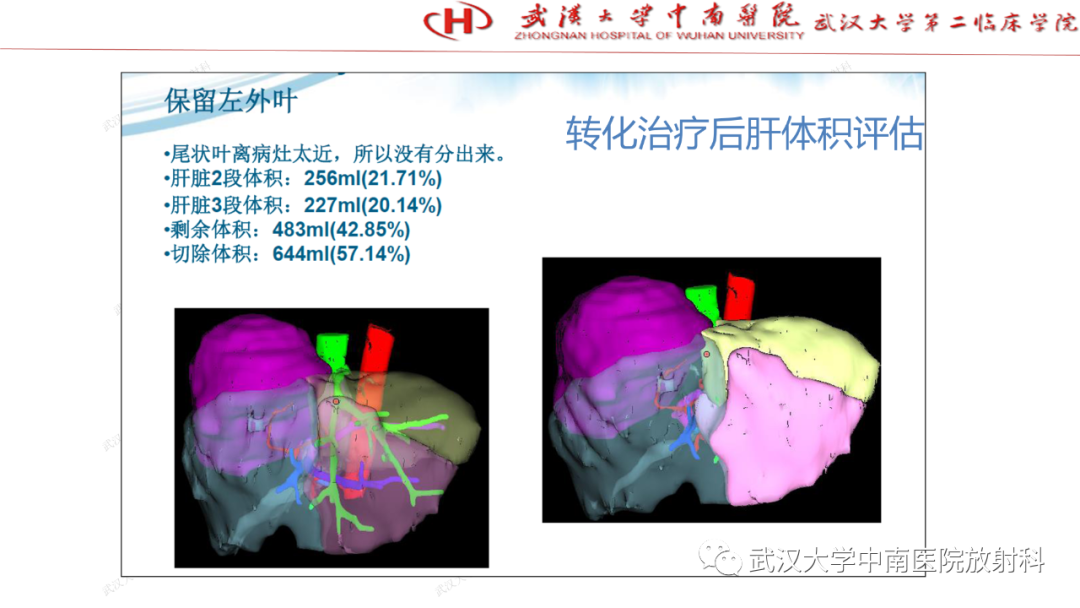 影像PPT - 【PPT】“不可切除”肝癌的TACE转化治疗-25