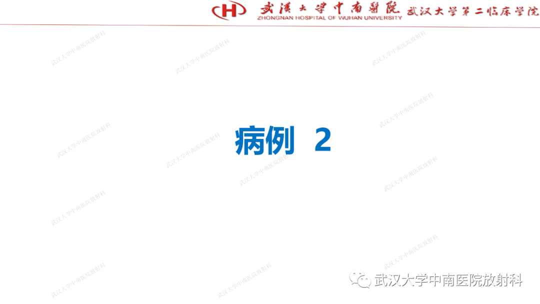 影像PPT - 【PPT】“不可切除”肝癌的TACE转化治疗-29