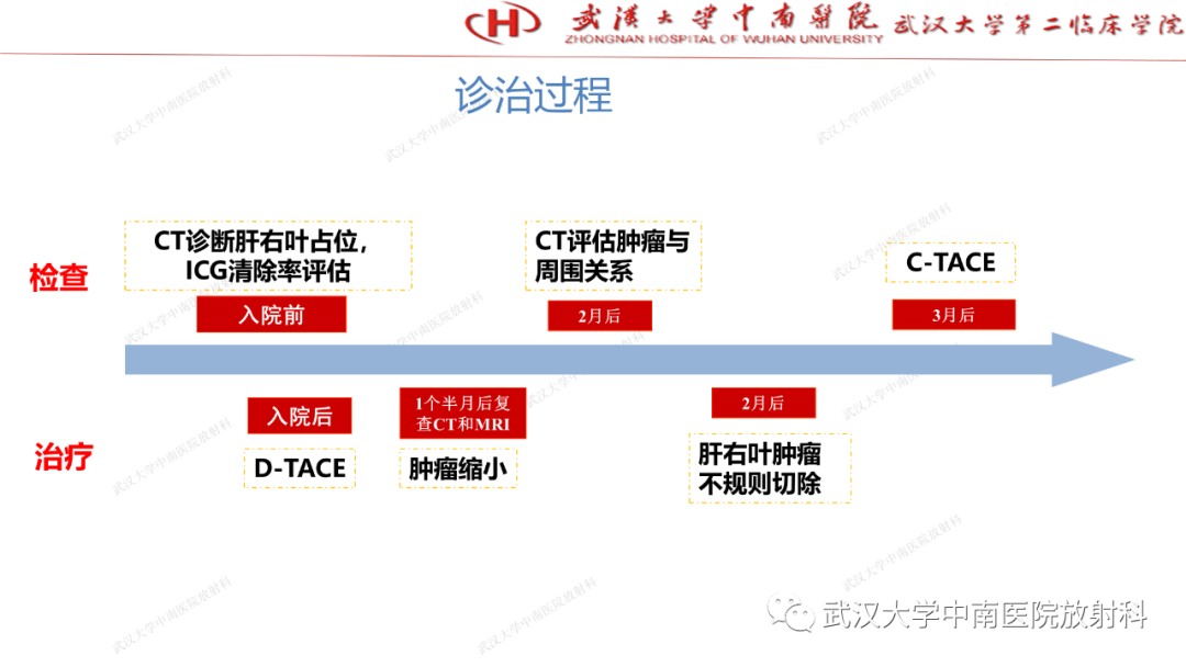 影像PPT - 【PPT】“不可切除”肝癌的TACE转化治疗-34