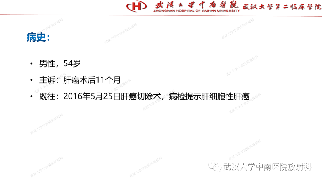 影像PPT - 【PPT】“不可切除”肝癌的TACE转化治疗-45