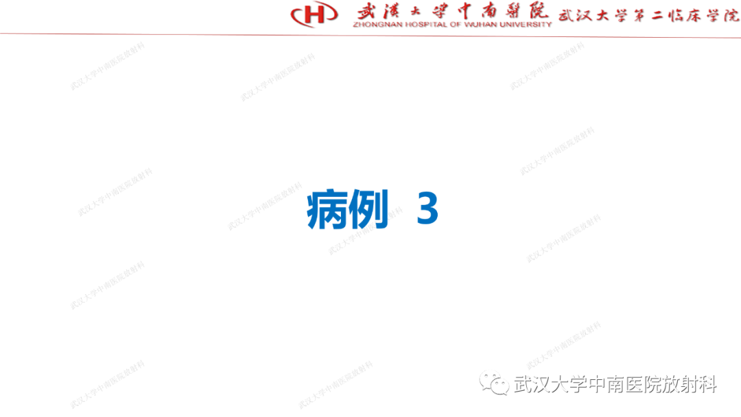 影像PPT - 【PPT】“不可切除”肝癌的TACE转化治疗-44