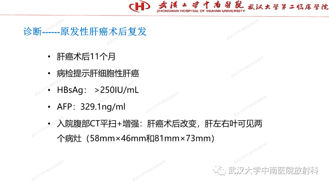 影像PPT - 【PPT】“不可切除”肝癌的TACE转化治疗-52