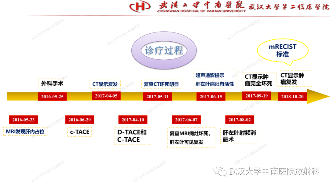 影像PPT - 【PPT】“不可切除”肝癌的TACE转化治疗-55