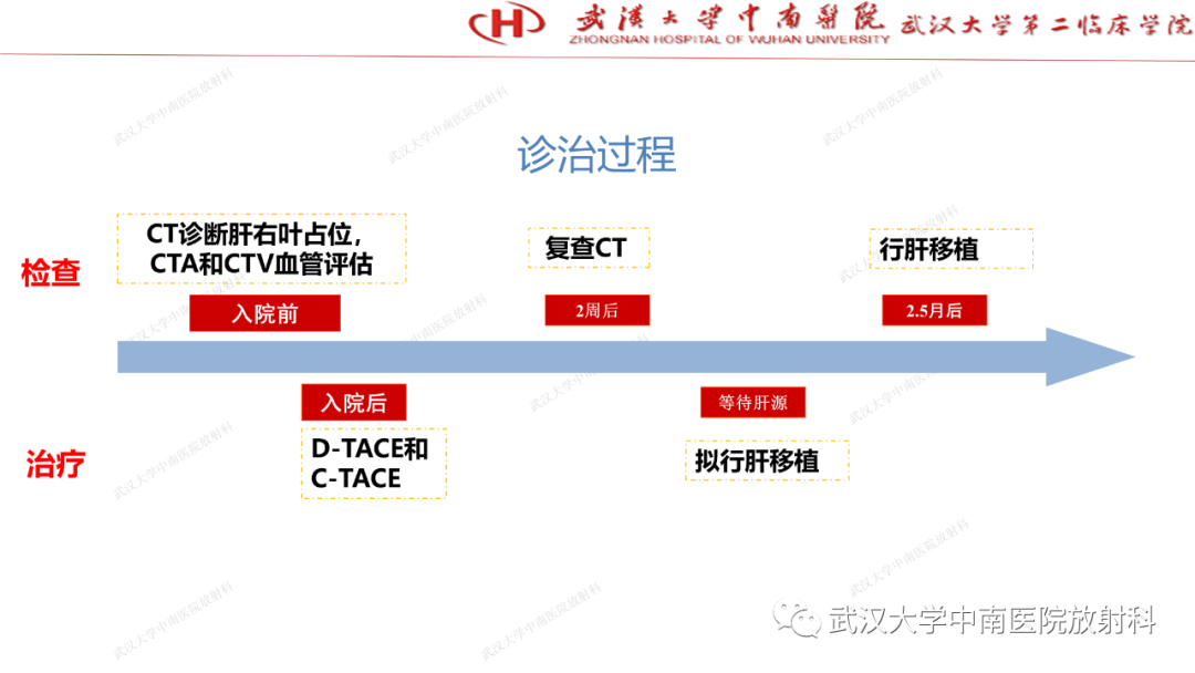 影像PPT - 【PPT】“不可切除”肝癌的TACE转化治疗-71
