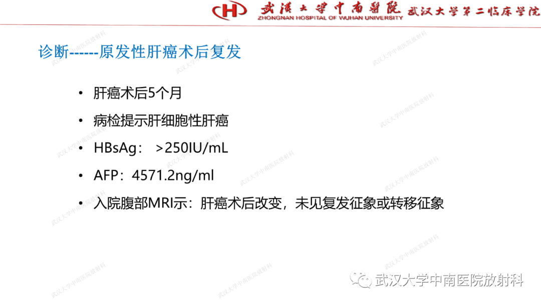 影像PPT - 【PPT】“不可切除”肝癌的TACE转化治疗-80