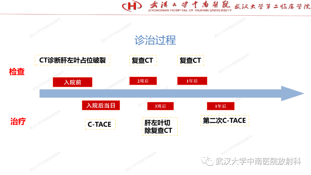 影像PPT - 【PPT】“不可切除”肝癌的TACE转化治疗-94
