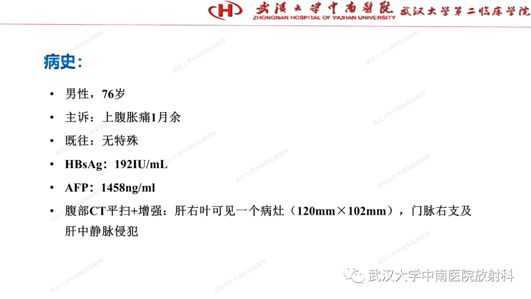 影像PPT - 【PPT】“不可切除”肝癌的TACE转化治疗-1