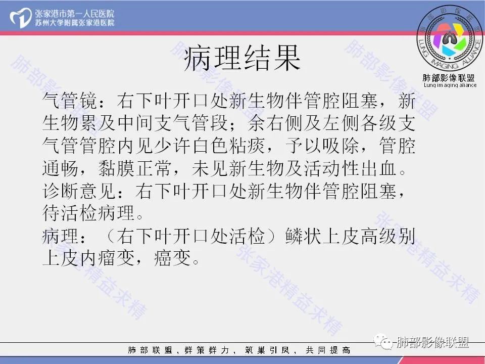 影像PPT - 【病例】肺鳞癌1例CT影像-17