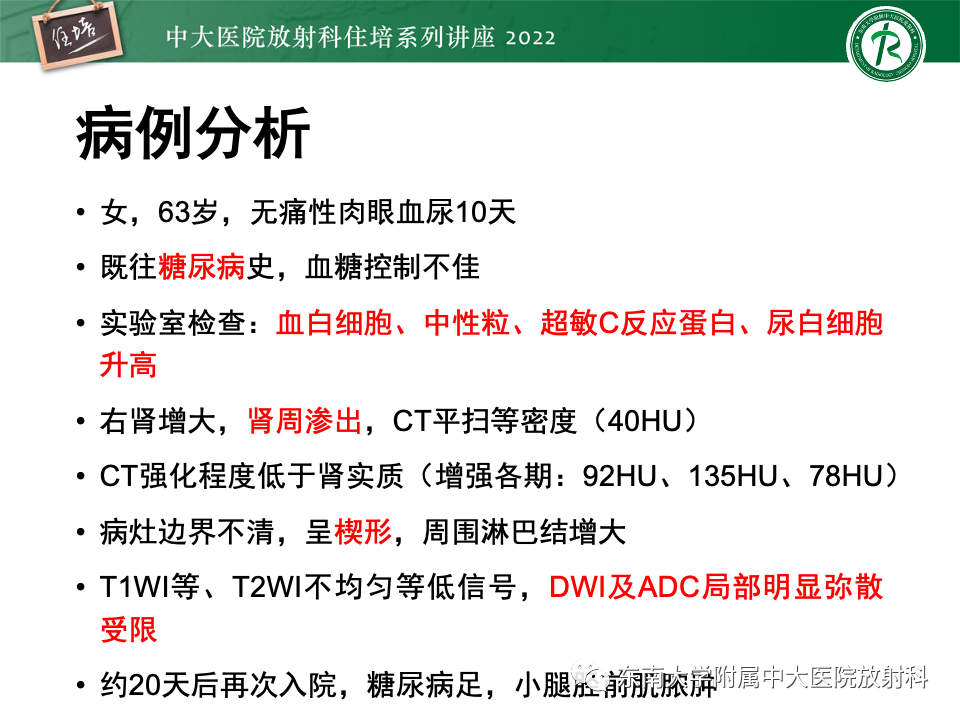 影像PPT - 【PPT】肾盂肾炎的影像表现及鉴别诊断-5