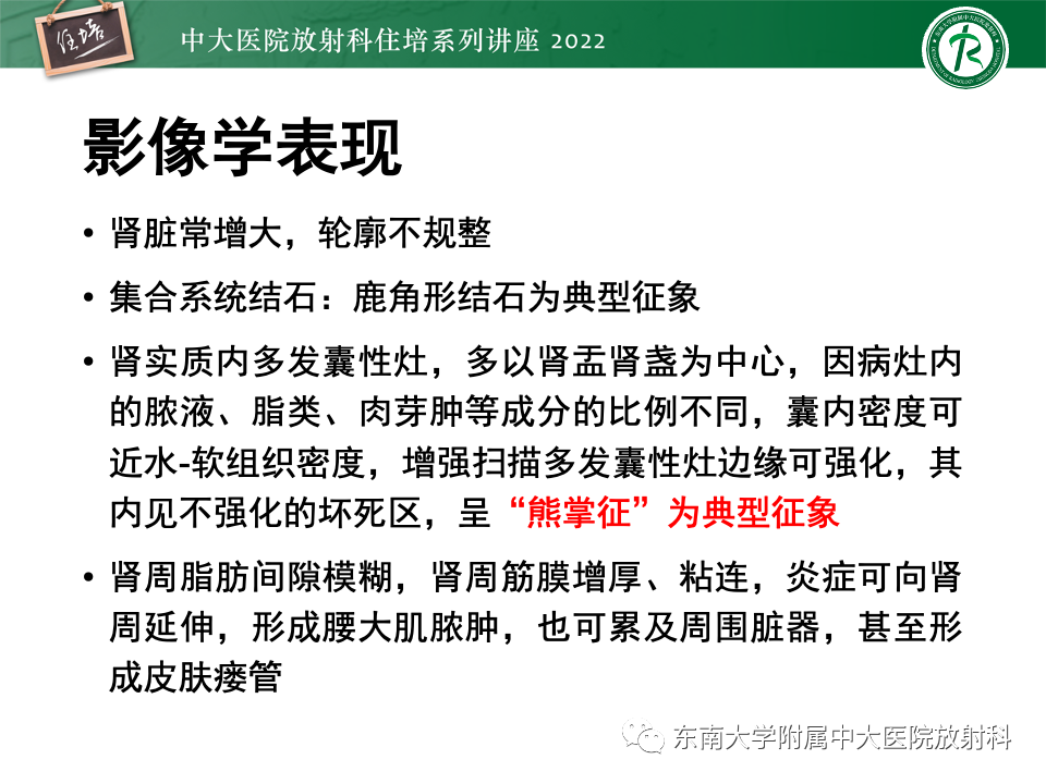 影像PPT - 【PPT】肾盂肾炎的影像表现及鉴别诊断-17