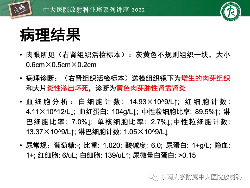 影像PPT - 【PPT】肾盂肾炎的影像表现及鉴别诊断-16