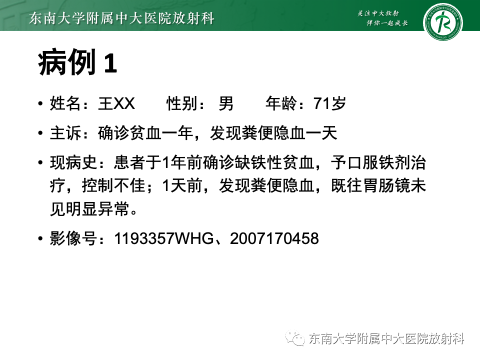 影像PPT - 【PPT】小肠间质瘤-4