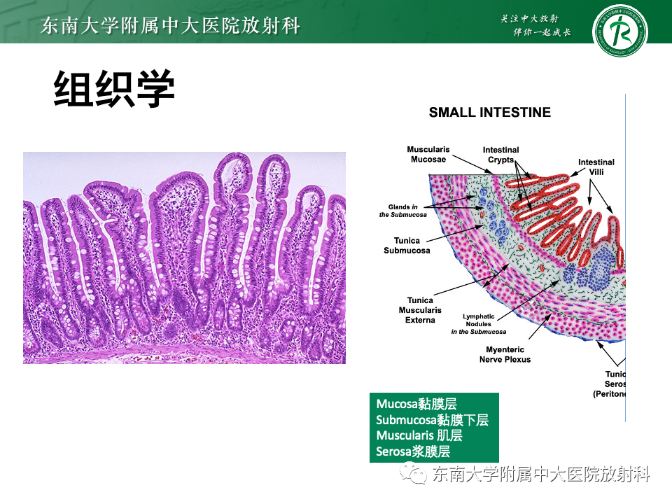 影像PPT - 【PPT】小肠间质瘤-11