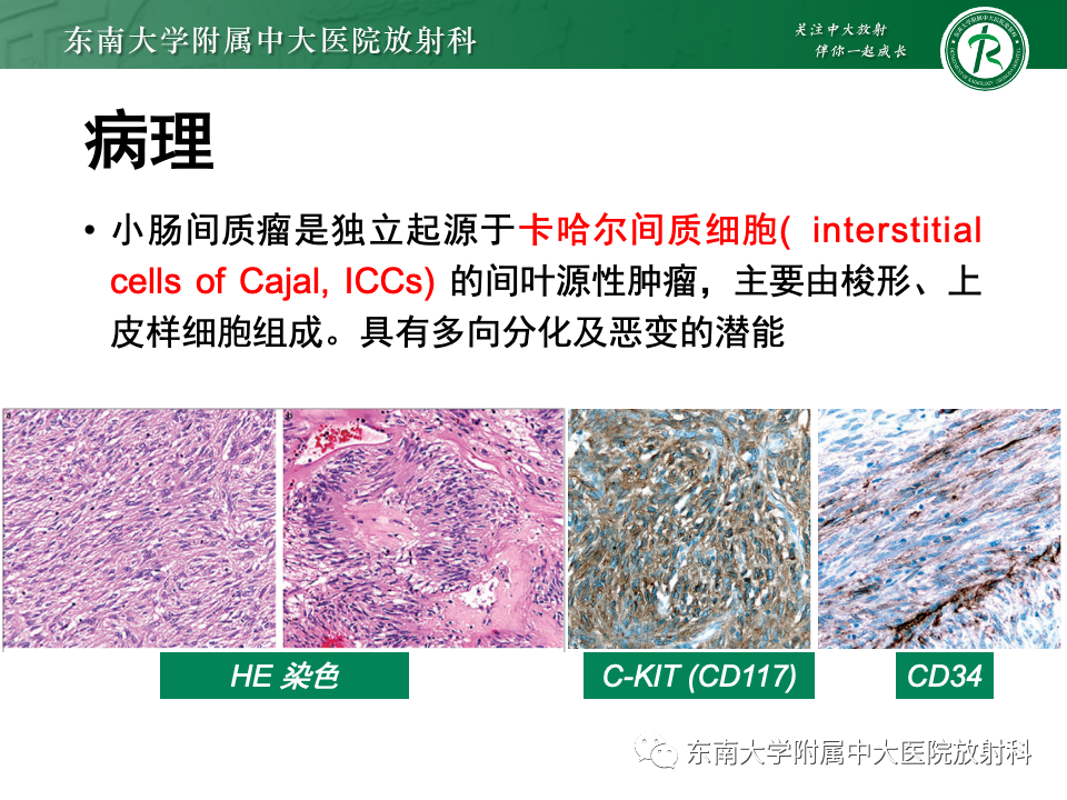 影像PPT - 【PPT】小肠间质瘤-13