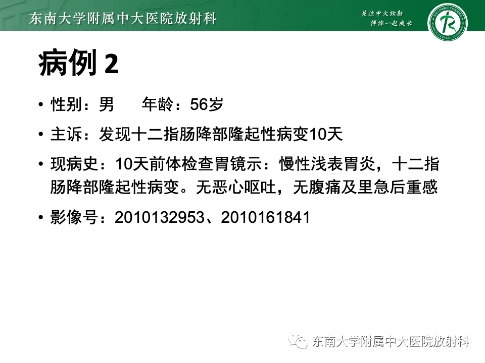 影像PPT - 【PPT】小肠间质瘤-17