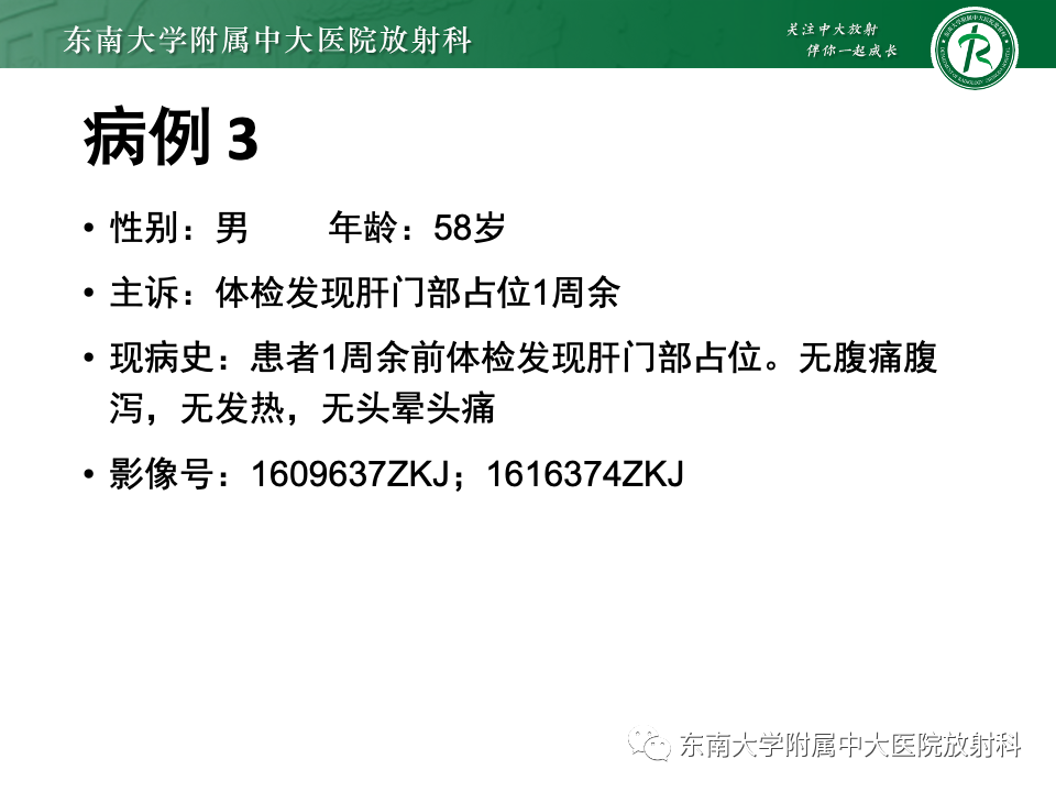 影像PPT - 【PPT】小肠间质瘤-24