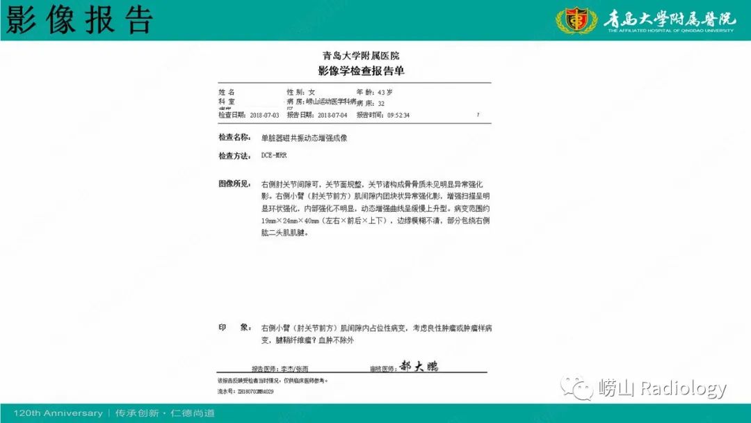 影像PPT - 【病例】肘关节腱鞘纤维瘤1例X线CT及MR-13