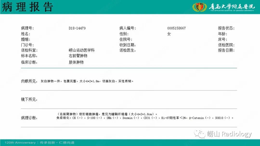 影像PPT - 【病例】肘关节腱鞘纤维瘤1例X线CT及MR-14