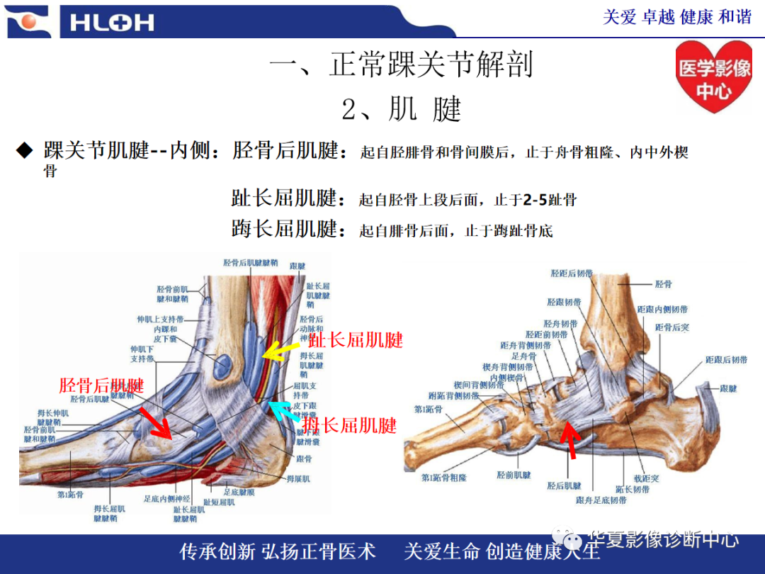 影像PPT - 【PPT】踝关节病变的MRI诊断-6