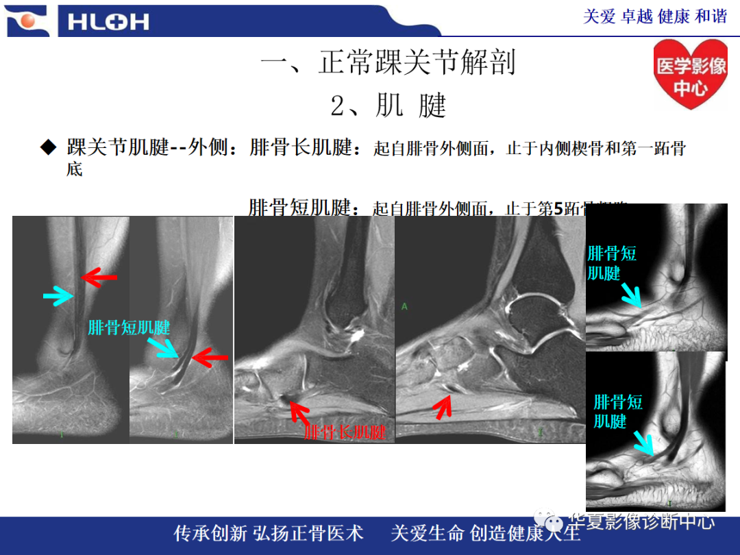 影像PPT - 【PPT】踝关节病变的MRI诊断-9