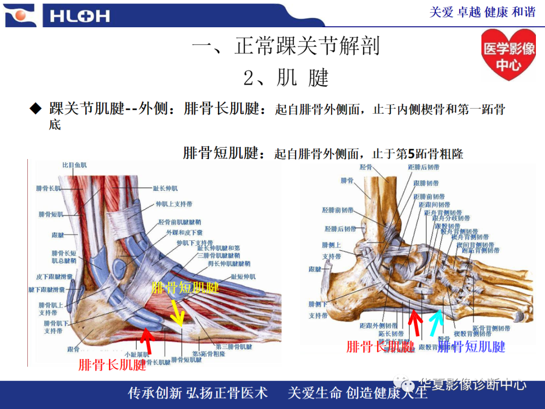 影像PPT - 【PPT】踝关节病变的MRI诊断-8