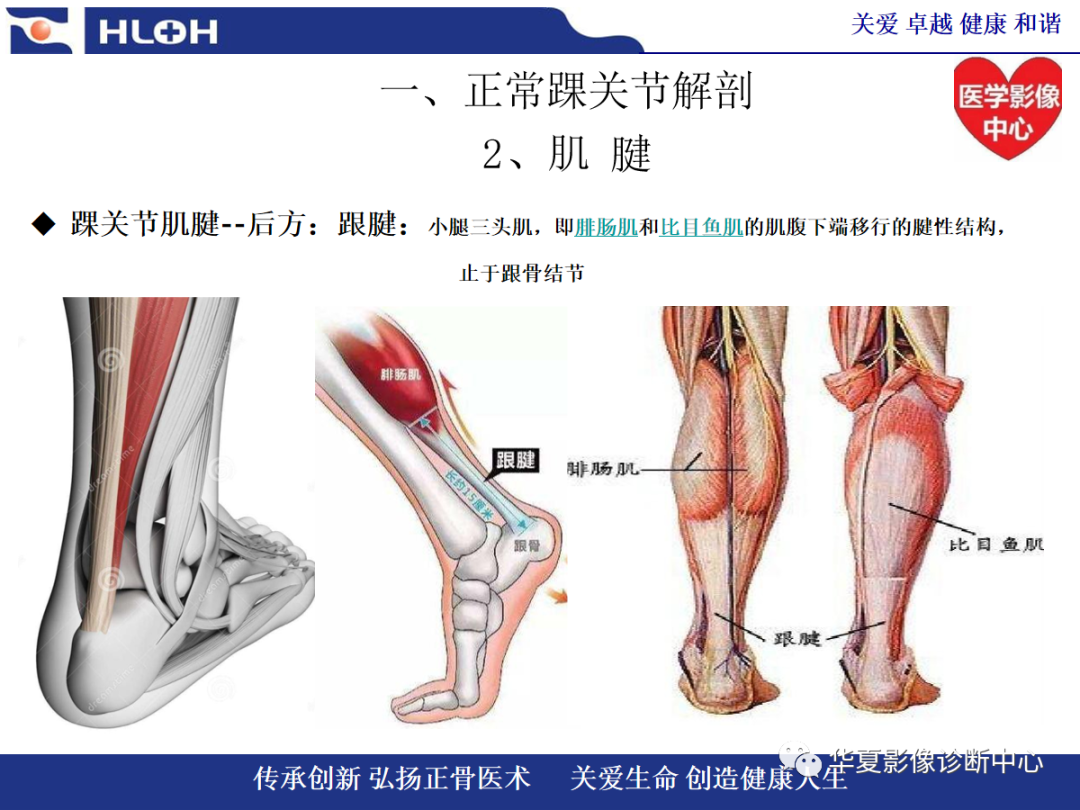 影像PPT - 【PPT】踝关节病变的MRI诊断-12