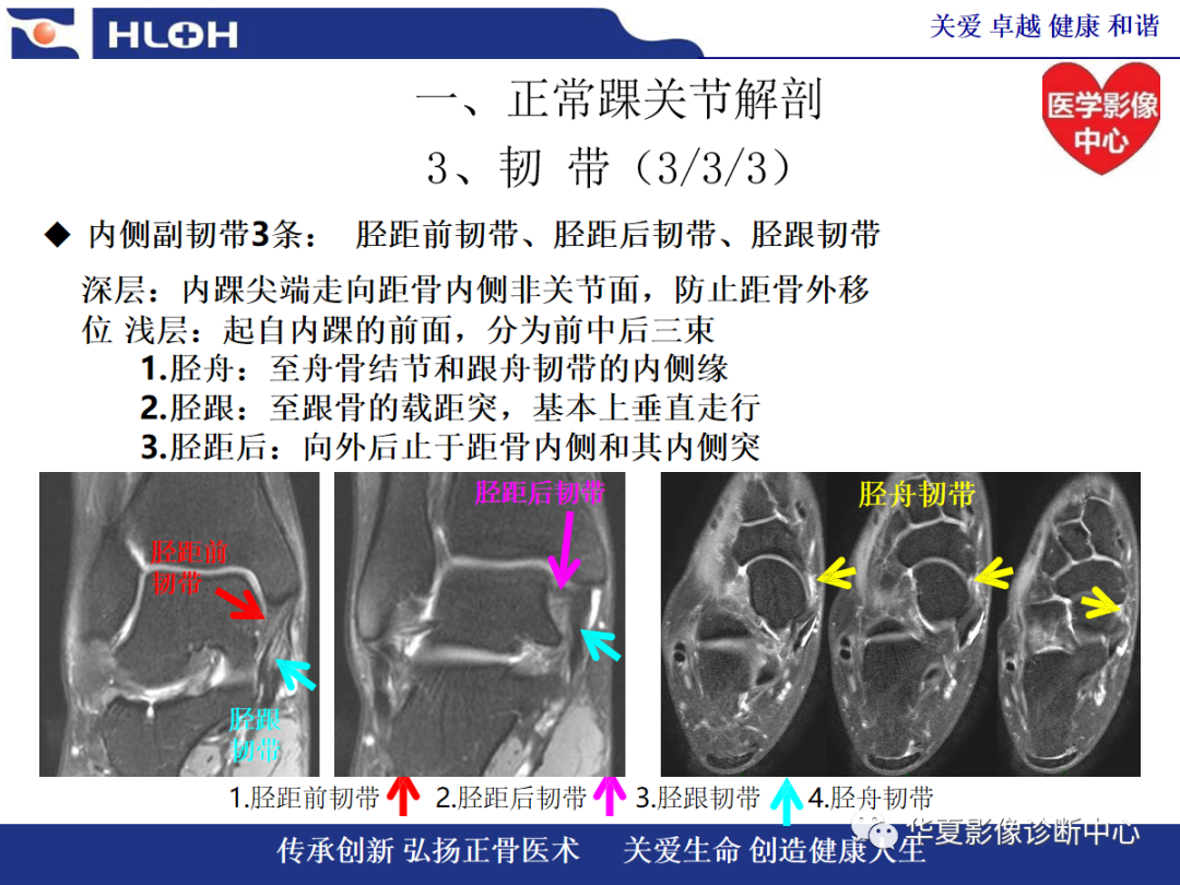影像PPT - 【PPT】踝关节病变的MRI诊断-17