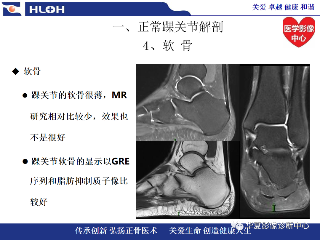 影像PPT - 【PPT】踝关节病变的MRI诊断-26