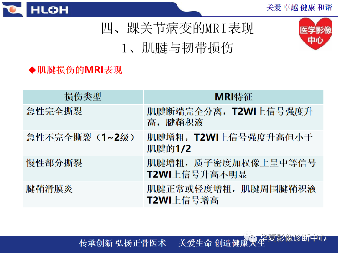 影像PPT - 【PPT】踝关节病变的MRI诊断-35