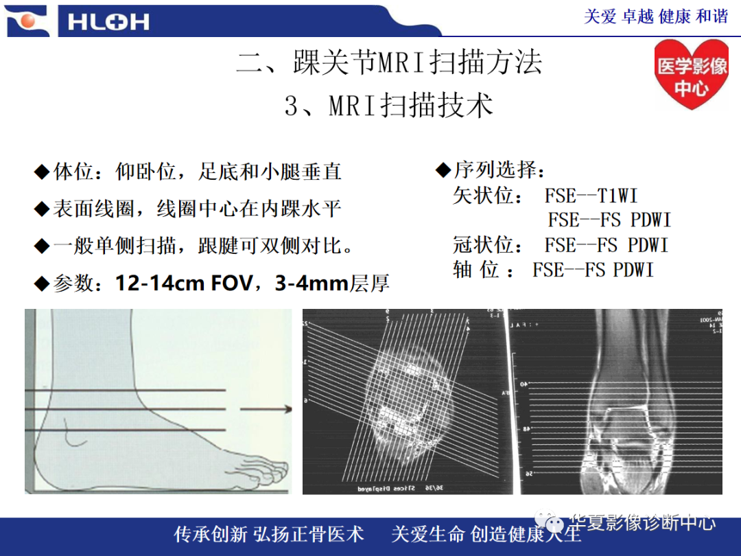 影像PPT - 【PPT】踝关节病变的MRI诊断-30