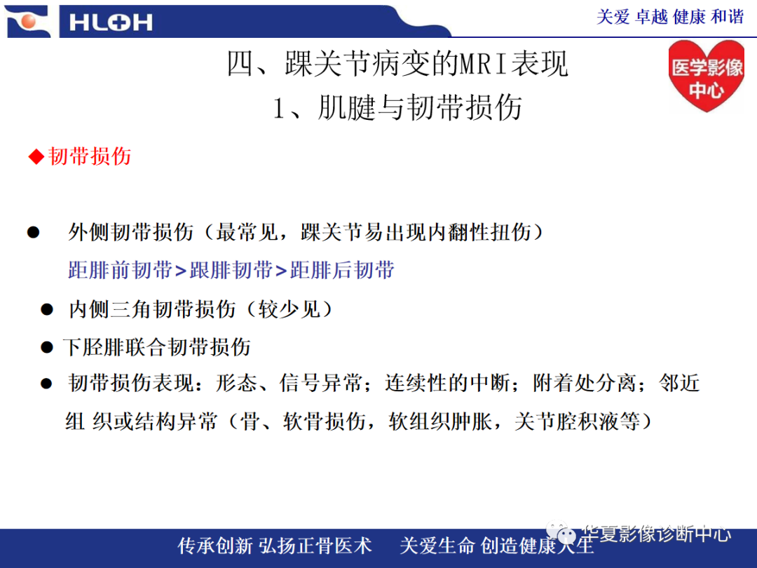 影像PPT - 【PPT】踝关节病变的MRI诊断-59