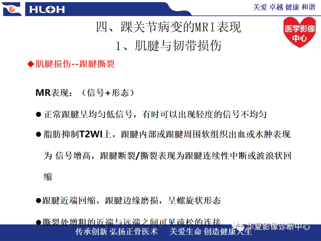影像PPT - 【PPT】踝关节病变的MRI诊断-51