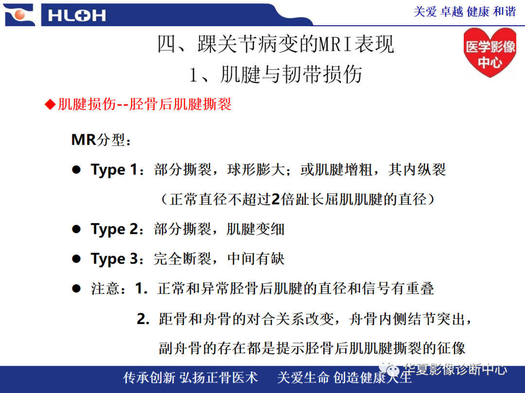 影像PPT - 【PPT】踝关节病变的MRI诊断-44