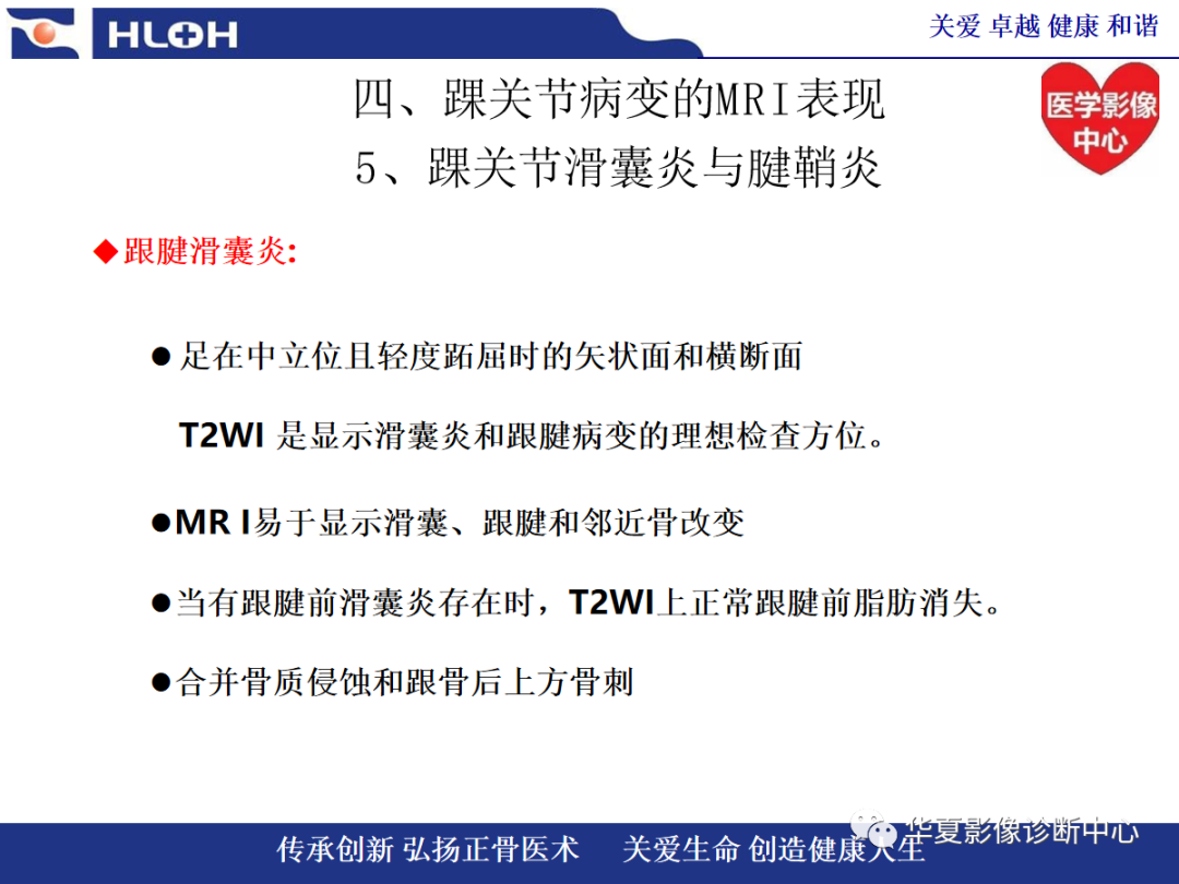 影像PPT - 【PPT】踝关节病变的MRI诊断-114