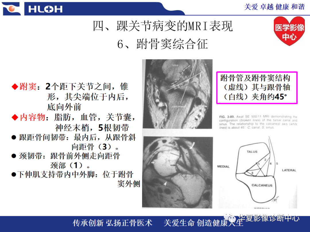影像PPT - 【PPT】踝关节病变的MRI诊断-120