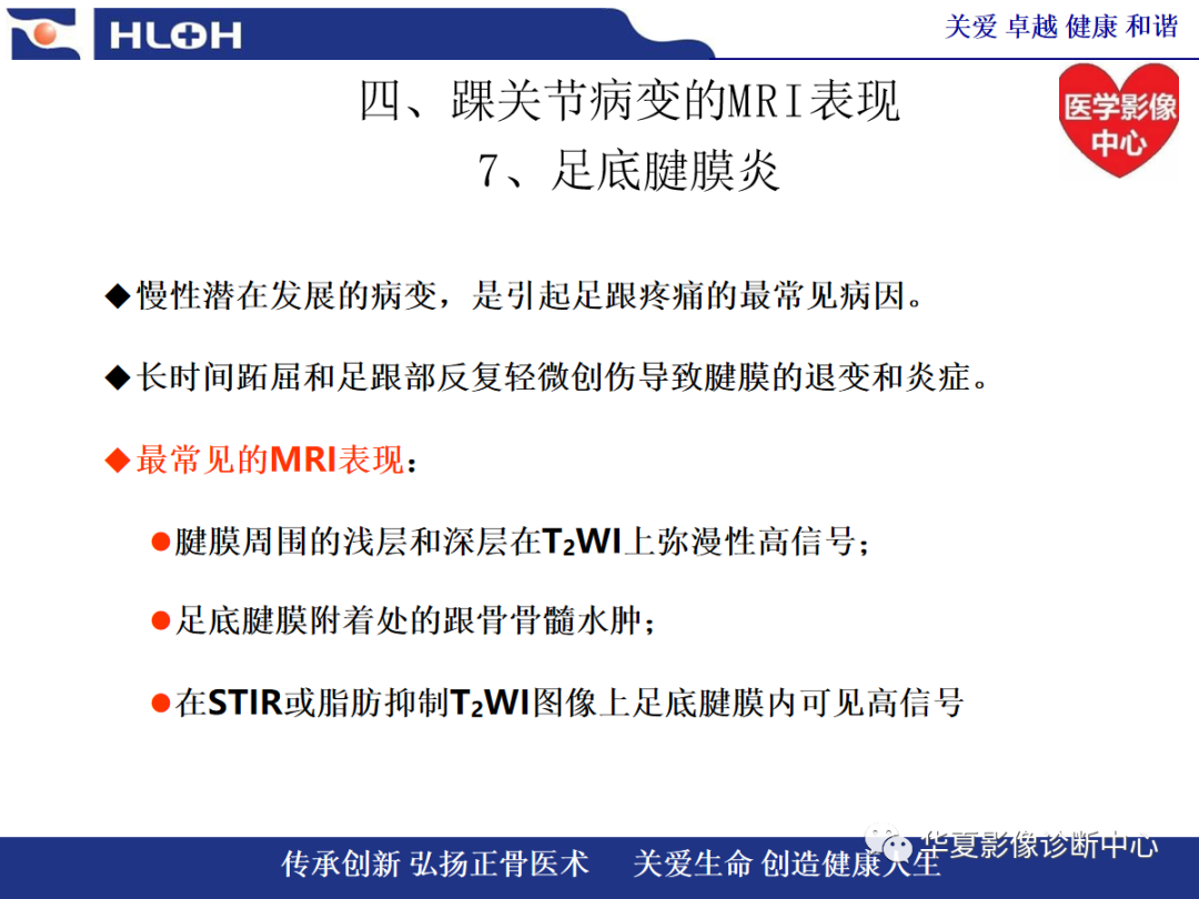 影像PPT - 【PPT】踝关节病变的MRI诊断-126