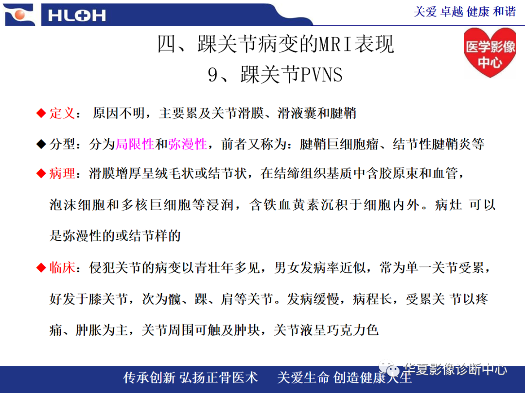 影像PPT - 【PPT】踝关节病变的MRI诊断-133