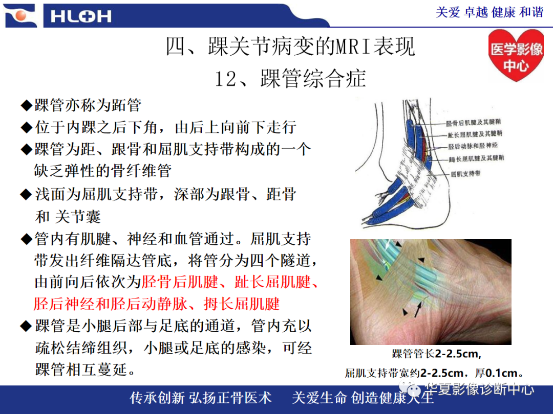 影像PPT - 【PPT】踝关节病变的MRI诊断-140