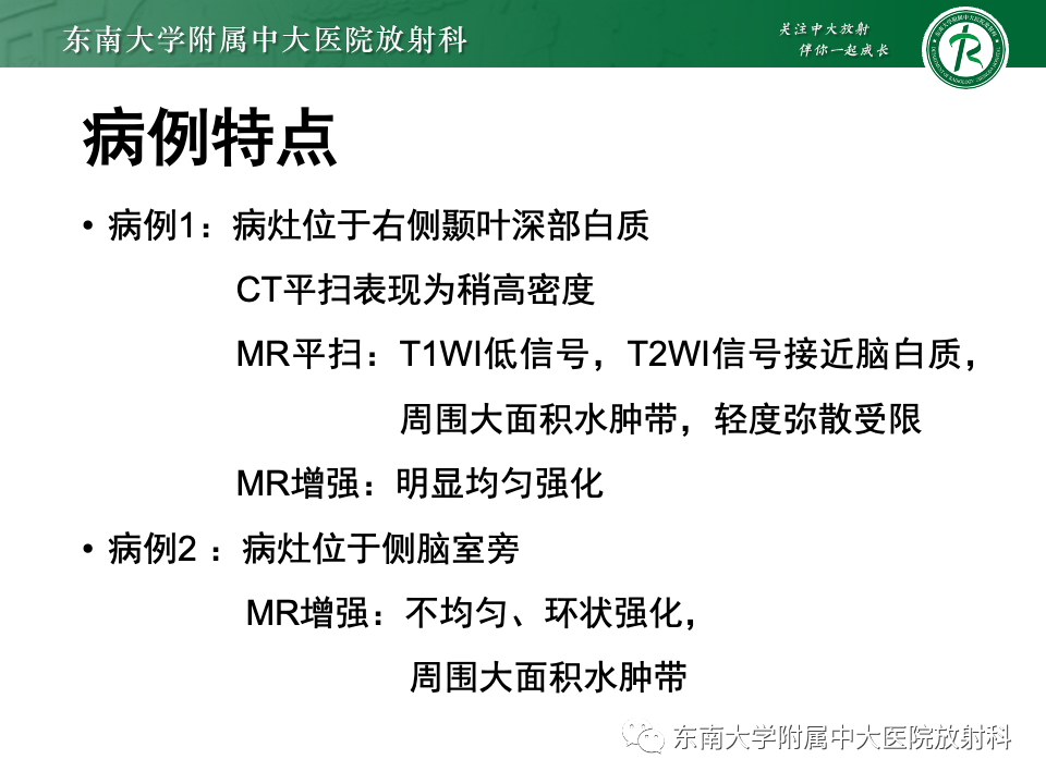影像PPT - 【PPT】原发性中枢神经系统淋巴瘤-10 影像PPT - 【PPT】原发性中枢神经系统淋巴瘤-10