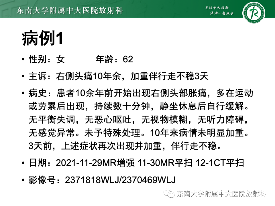 影像PPT - 【PPT】原发性中枢神经系统淋巴瘤-4 影像PPT - 【PPT】原发性中枢神经系统淋巴瘤-4