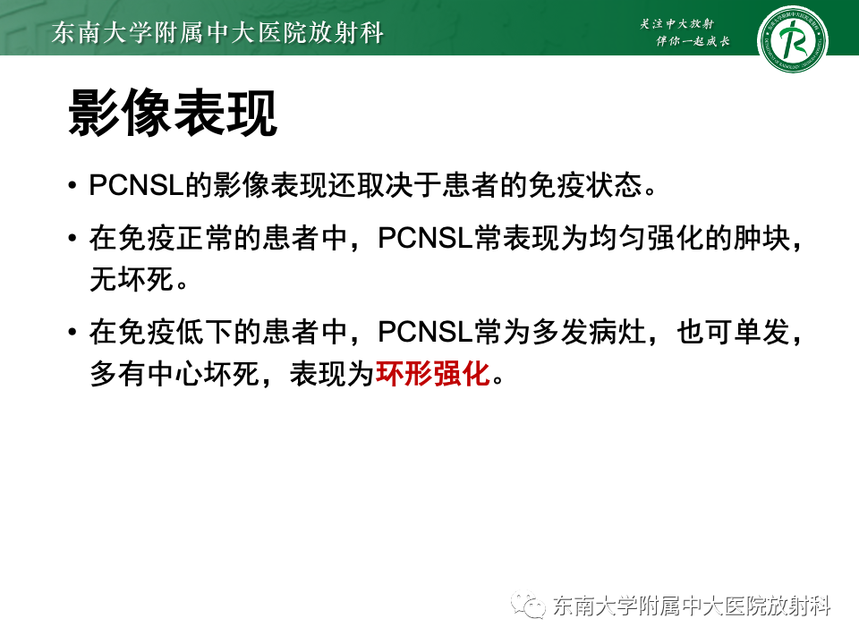 影像PPT - 【PPT】原发性中枢神经系统淋巴瘤-16 影像PPT - 【PPT】原发性中枢神经系统淋巴瘤-16