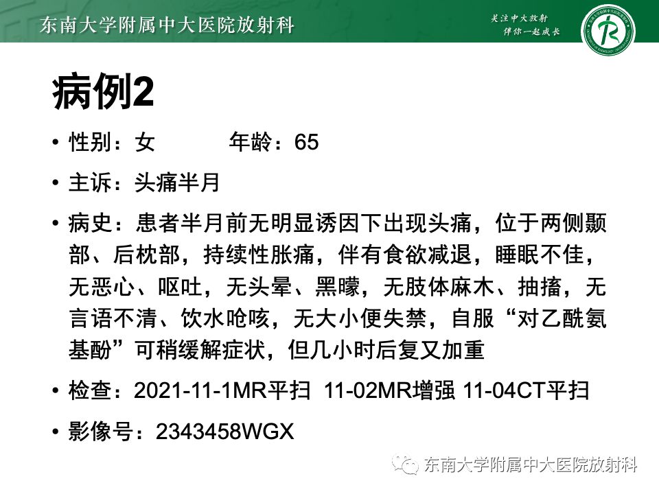 影像PPT - 【PPT】原发性中枢神经系统淋巴瘤-23 影像PPT - 【PPT】原发性中枢神经系统淋巴瘤-23