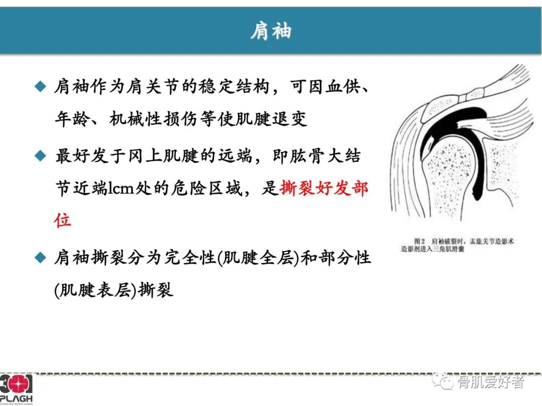 影像PPT - 【PPT】肩关节解剖与运动损伤影像诊断-12